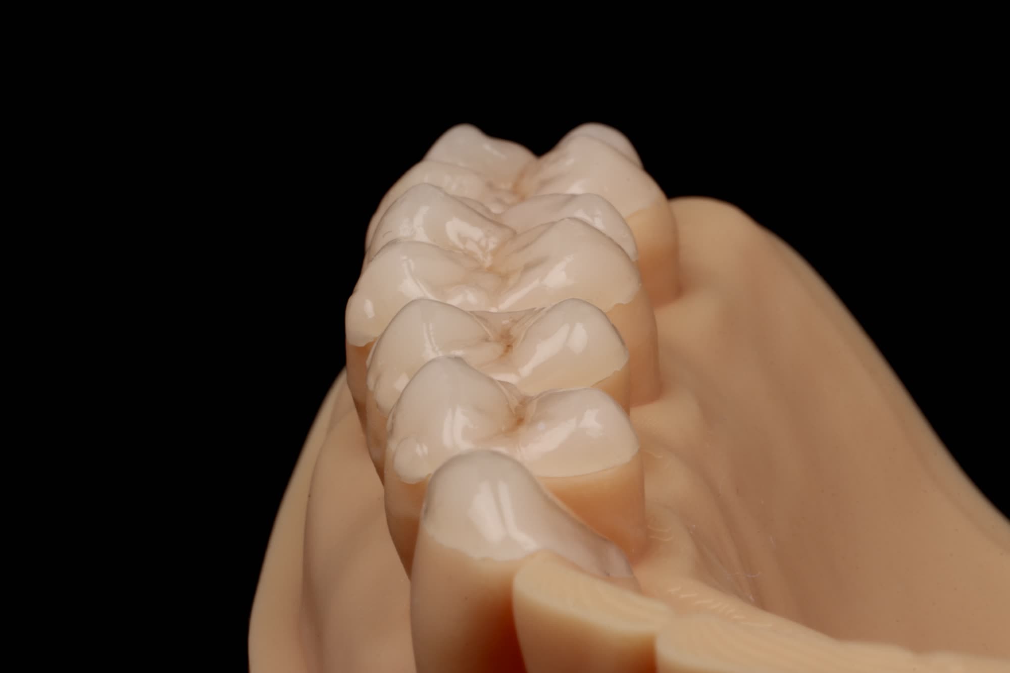 FULL MOUTH WORKSHOP
